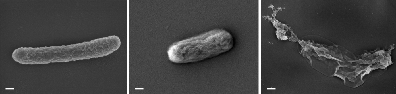 Treatment of bacteria: scanning electron images of Escherichia coli