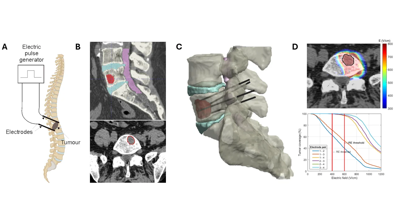 Cell geometries and simulation setup for cardiomyocyte electroporation