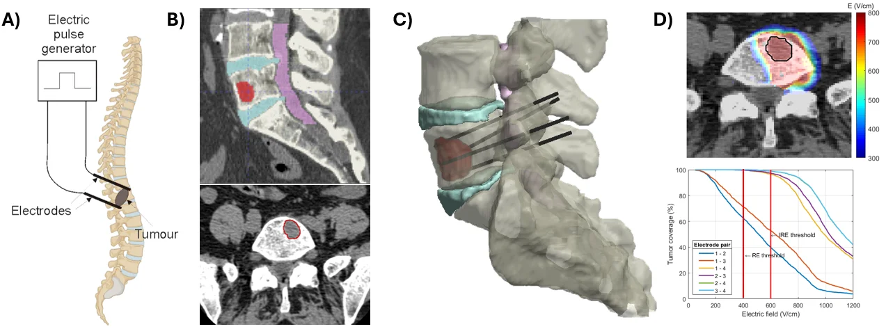 Pulsed field ablation in infarcted ventricles